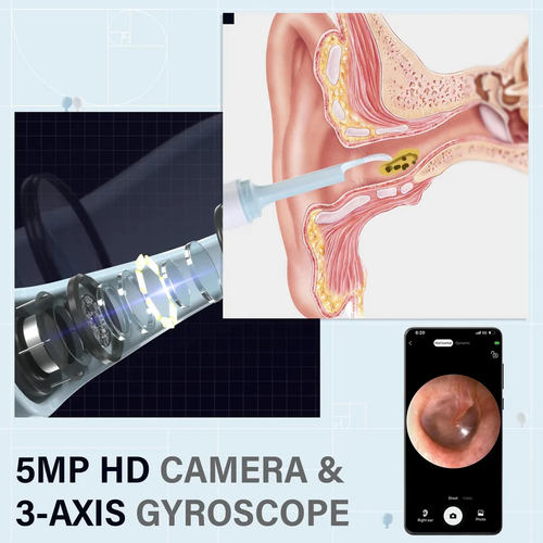 Earwax Removal Tool Kit with Camera - Portable 360° Wide Angle Ear Cleaner with Type-C Charging Function, Waterproof Endoscopic Ear Cleaning Tool for iPhone and Android Phones