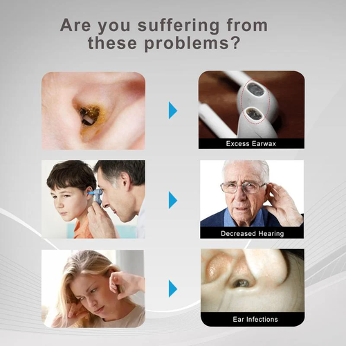 Earwax Removal Tool Kit with Camera - Portable 360° Wide Angle Ear Cleaner with Type-C Charging Function, Waterproof Endoscopic Ear Cleaning Tool for iPhone and Android Phones