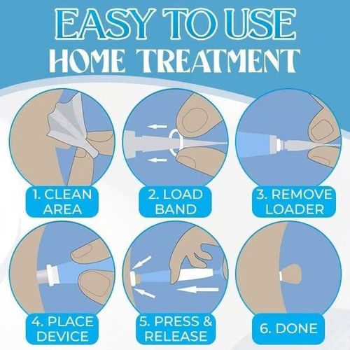 Auto Micro Skin Tag Remover