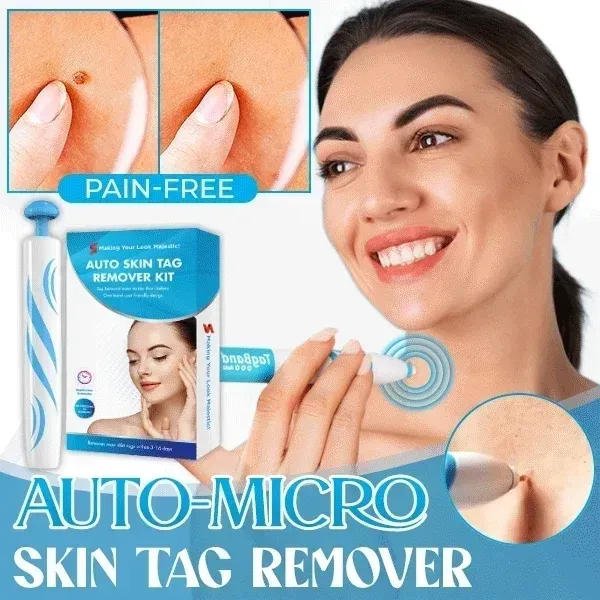 Auto Micro Skin Tag Remover