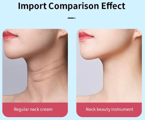 EMS Thermal Neck Lifting And Tighten Massager Electric Microcurrent Wrinkle Remover LED Photon Face Beauty Device For Woman