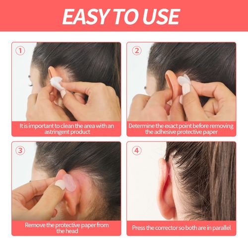 Cosmetic Discreet Protruding Ear Aesthetic Corrector Ear Care Products for Ear Pinning Without Surgery
