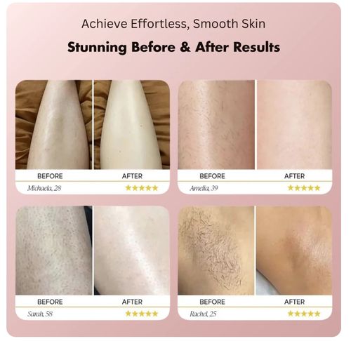 Electric shaver for women