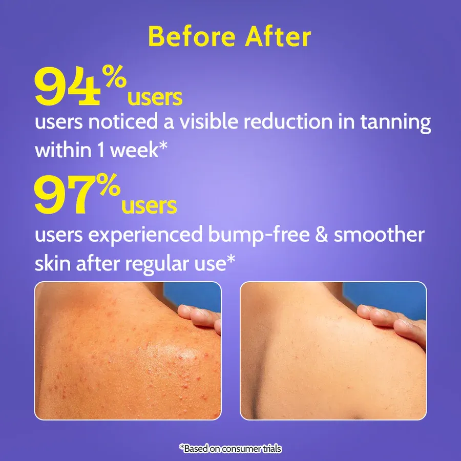 Exfoliating Body Wash with Lactic Acid & Salicylic Acid - 236 ml