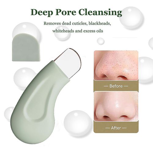 Ergonomic blackhead scraper silicone cap acne removal facial pore cleaning artifact portable skin scraper