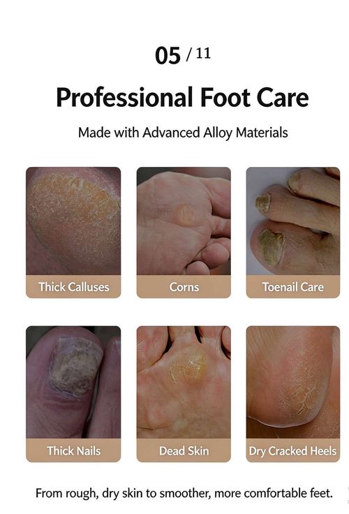 Electric Foot File