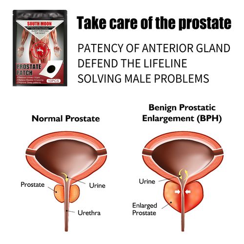 Forefront Plaster Prostate Cream Patch Body Care Belly Button Patch Men's Locked Up Strong Kidney Care