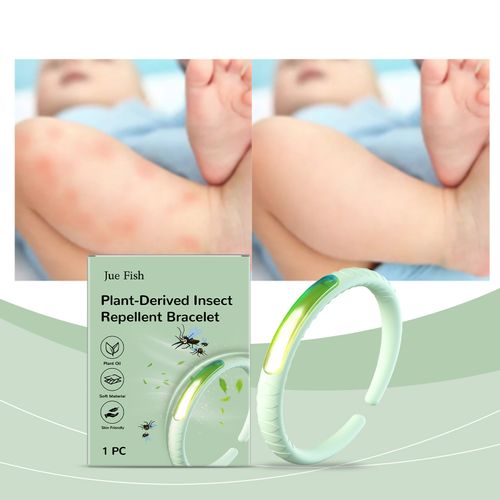 Jue-Fish Mosquito Repellent Bracelet Daily Gentle Outdoor Portable Fresh Home Travel Kids Bite-Proof Bracelet