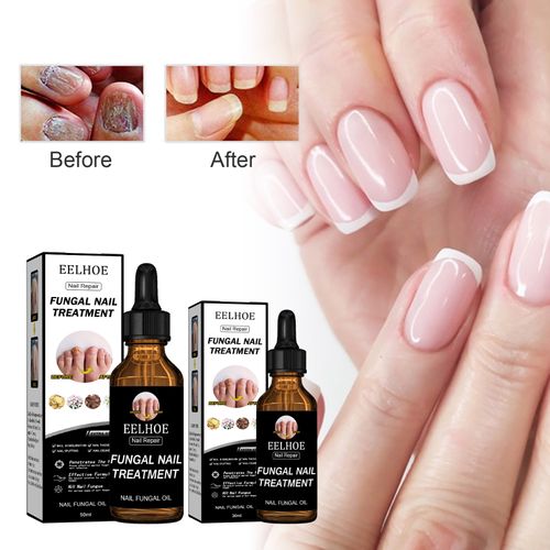 EELHOE Nail Care Serum Moisturizing and nourishing care for bright, smooth, and beautiful nails Daily nourishment for radiant, translucent nails