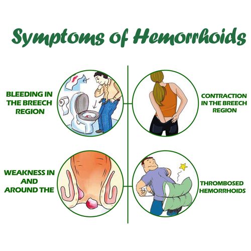 South Moon Herbal Hemorrhoid Spray Fleshball Relief Swelling Hemorrhoid Pain Topical Breakthrough Anal Spray