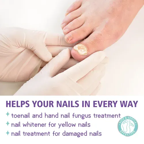 Medical Grade Nail Care Spray for Fingernails & Toenails | Soften Clean Repair Yellow Thick Ingrown Nails