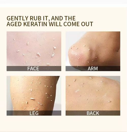Exfoliating Gel