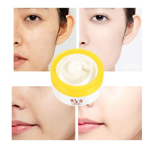 TWG Acne Mark Removal Face Cream & Lotion Skin Brightening Lightening Spot Beauty Salon Astragalus Whitening Face Cream Buy 1, Get 1 Free - Total 2 Pieces Sent