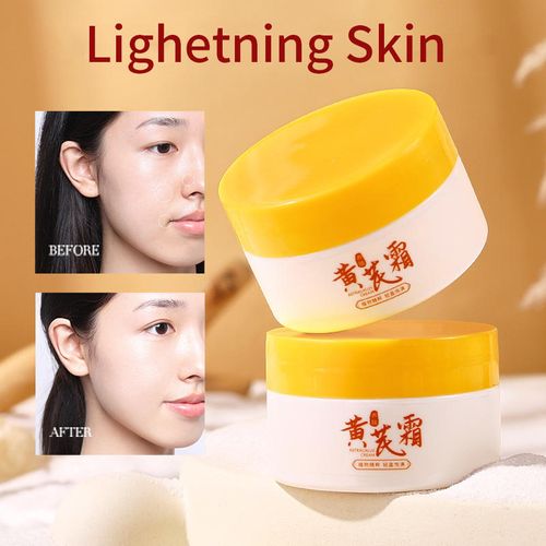 TWG Acne Mark Removal Face Cream & Lotion Skin Brightening Lightening Spot Beauty Salon Astragalus Whitening Face Cream Buy 1, Get 1 Free - Total 2 Pieces Sent