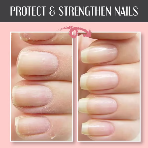 🔥Nail Repair Protection Gel