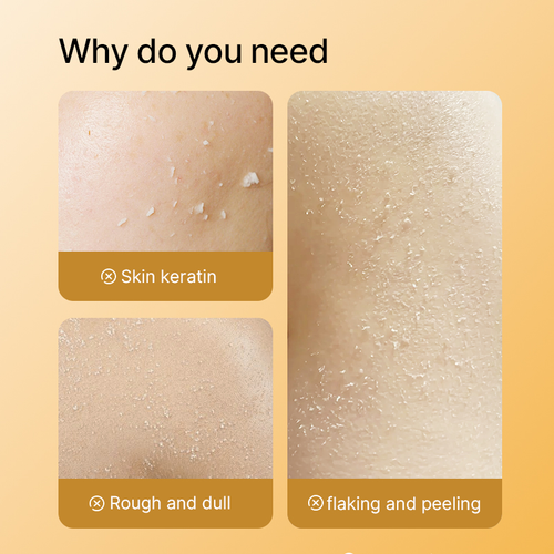 Exclusive Organic Body & Face Exfoliating Spray — Infused with Kojic Acid and Turmeric — Deep Cleansing, Exfoliating, Moisturizing, and Skin-Smoothing — Suitable for Women