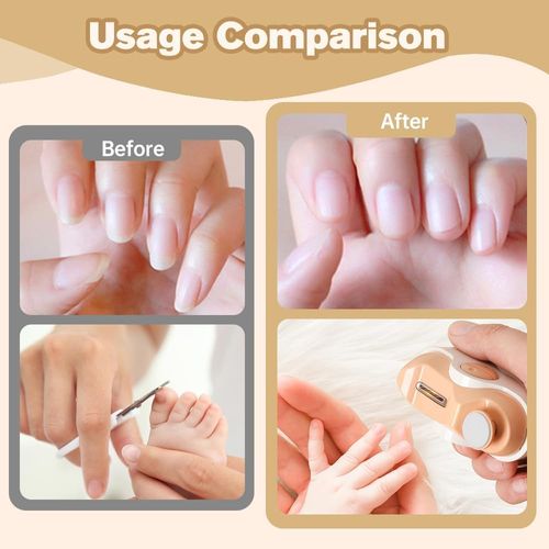 ⚡HOT SELLER LIMIT STOCK⚡ 2 In 1 Electric Nail Trimmer & Polisher, Gentle Cut for Daily Nail Care