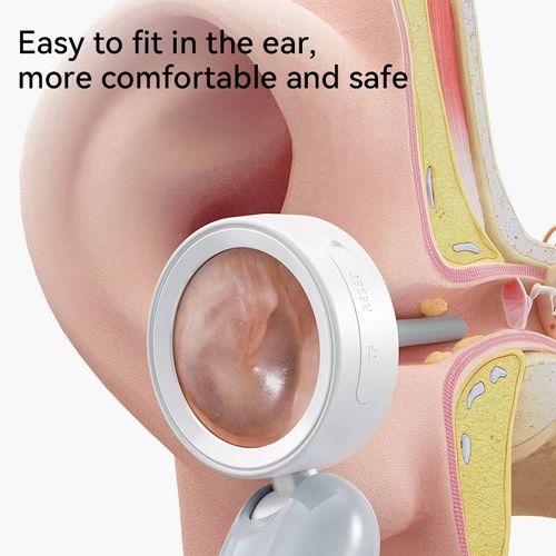 Otoscope caméra 1080P rotatif nettoyage cérumen COD