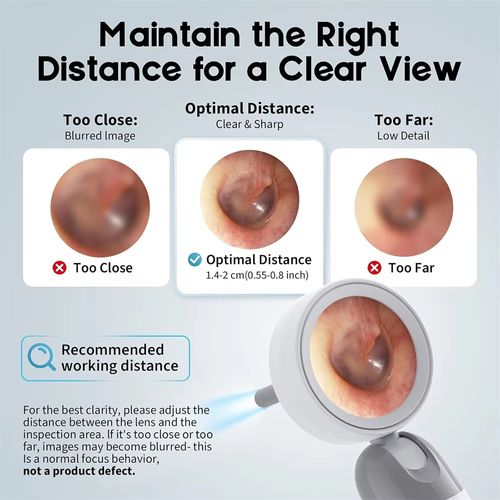 Otoscope caméra 1080P rotatif nettoyage cérumen COD