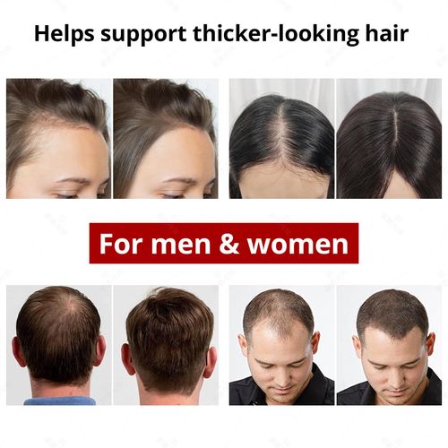 Red light hair growth cap built with 96 LEDs, wireless charging design and 4 adjustable levels, used for hair regeneration and scalp care to get thicker fuller hair, free shipping and cash on delivery