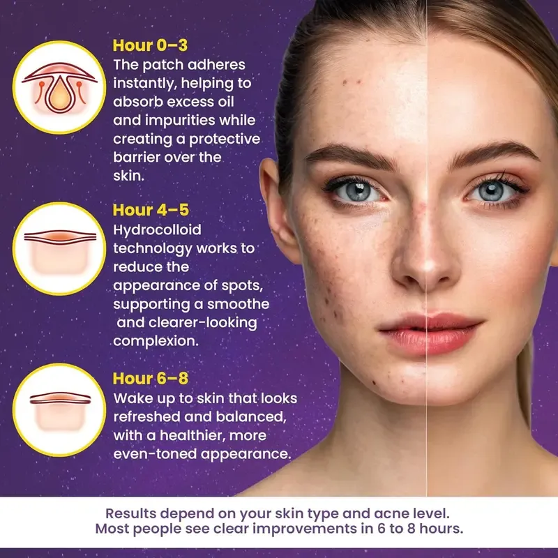 1400 Pieces Facial Hydrocolloid Acne Patches Acne Pimple Patch Cute Star Shaped Coverings Acne Stickers Acne Clearing Products Alcohol Free Odorless Gentle Mild and Non Irritating Suitable for All Skin Types Mothers Day Gift