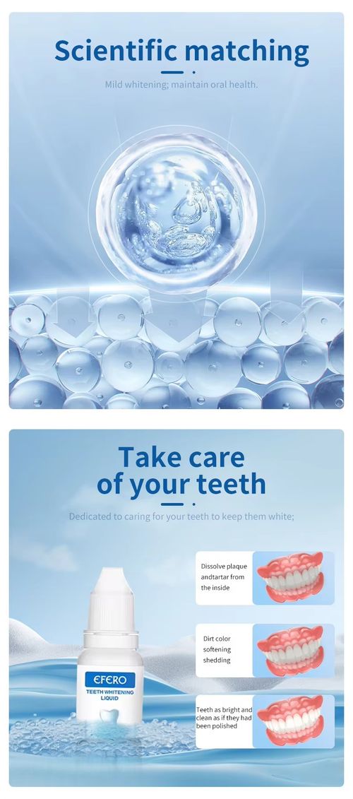 Teeth Whitening