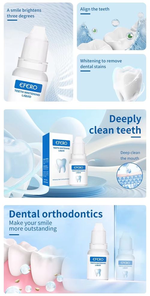 Teeth Whitening