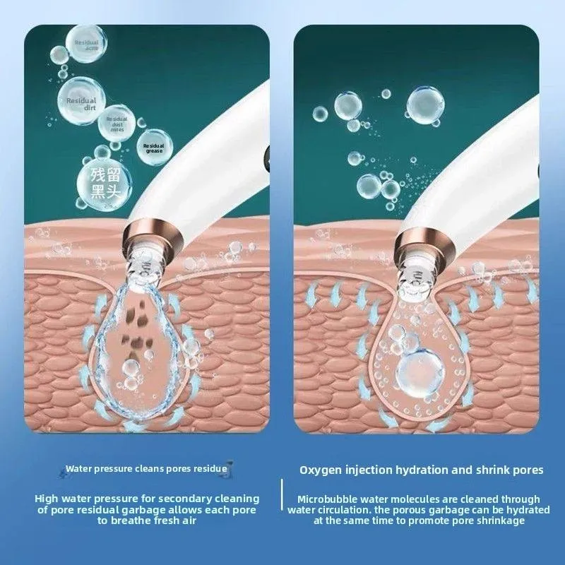 Microbubble Pore Cleanser