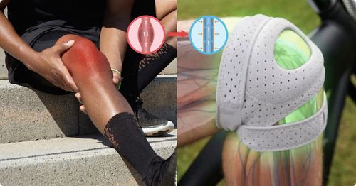 Sports Medicine  Knee Brace  1pcs adjustable breathable knee support bracket