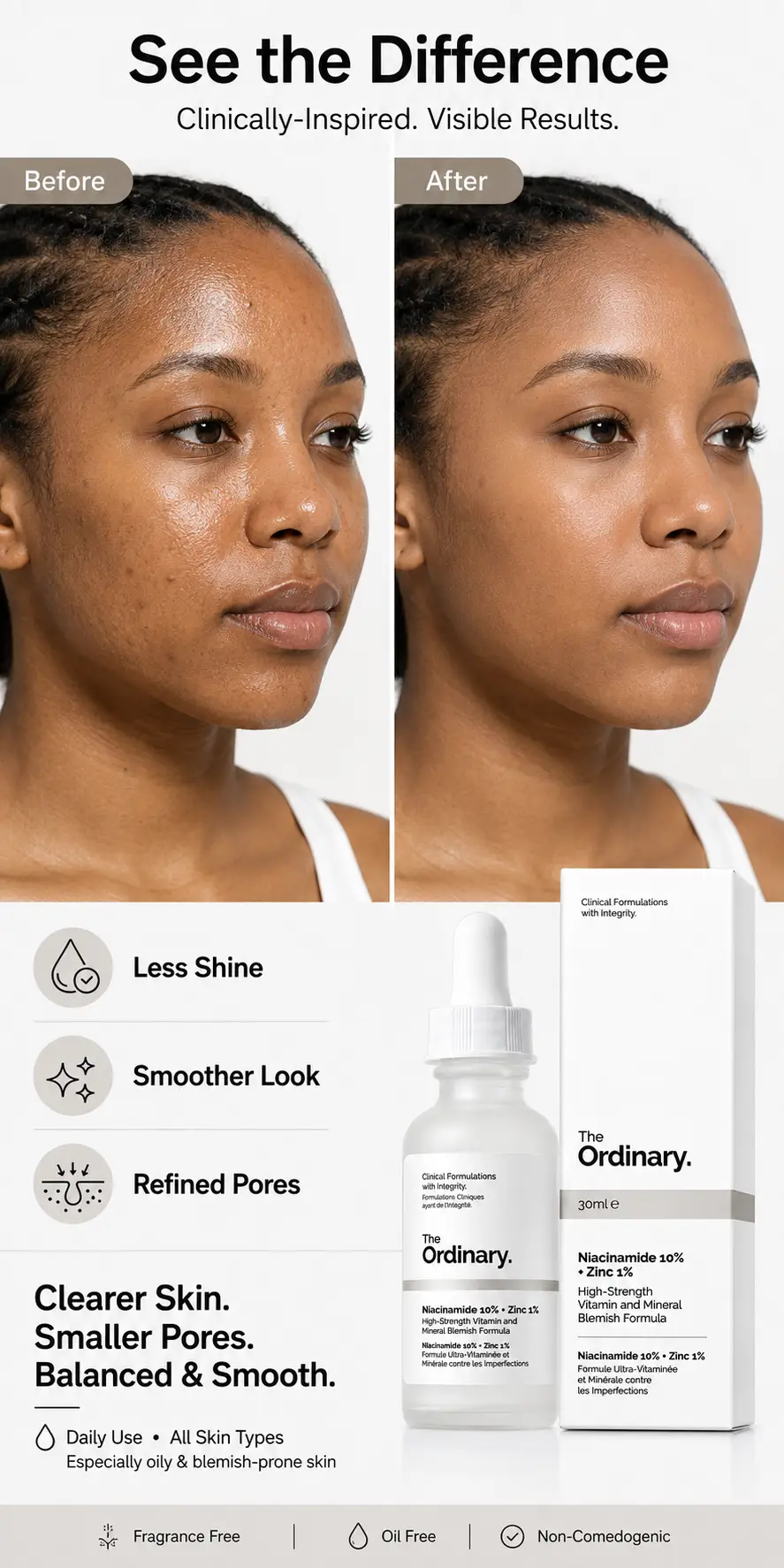 The Ordinary Niacinamide 10% + Zinc 1% Oil Control Serum 30ml detail 5