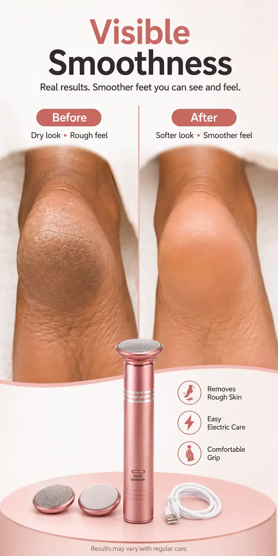 Electric Foot Callus Remover detail 5