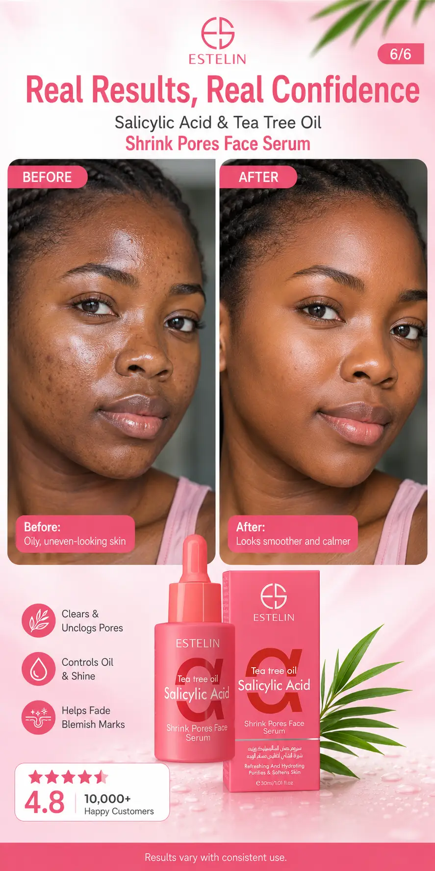 ESTELIN Salicylic Acid & Tea Tree Oil Shrink Pores Face Serum 30ml detail 4